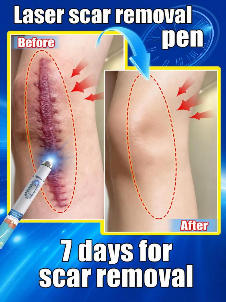 Home Improvement Mark - Alat Perawatan Kecantikan Kulit Genggam Portabel,
